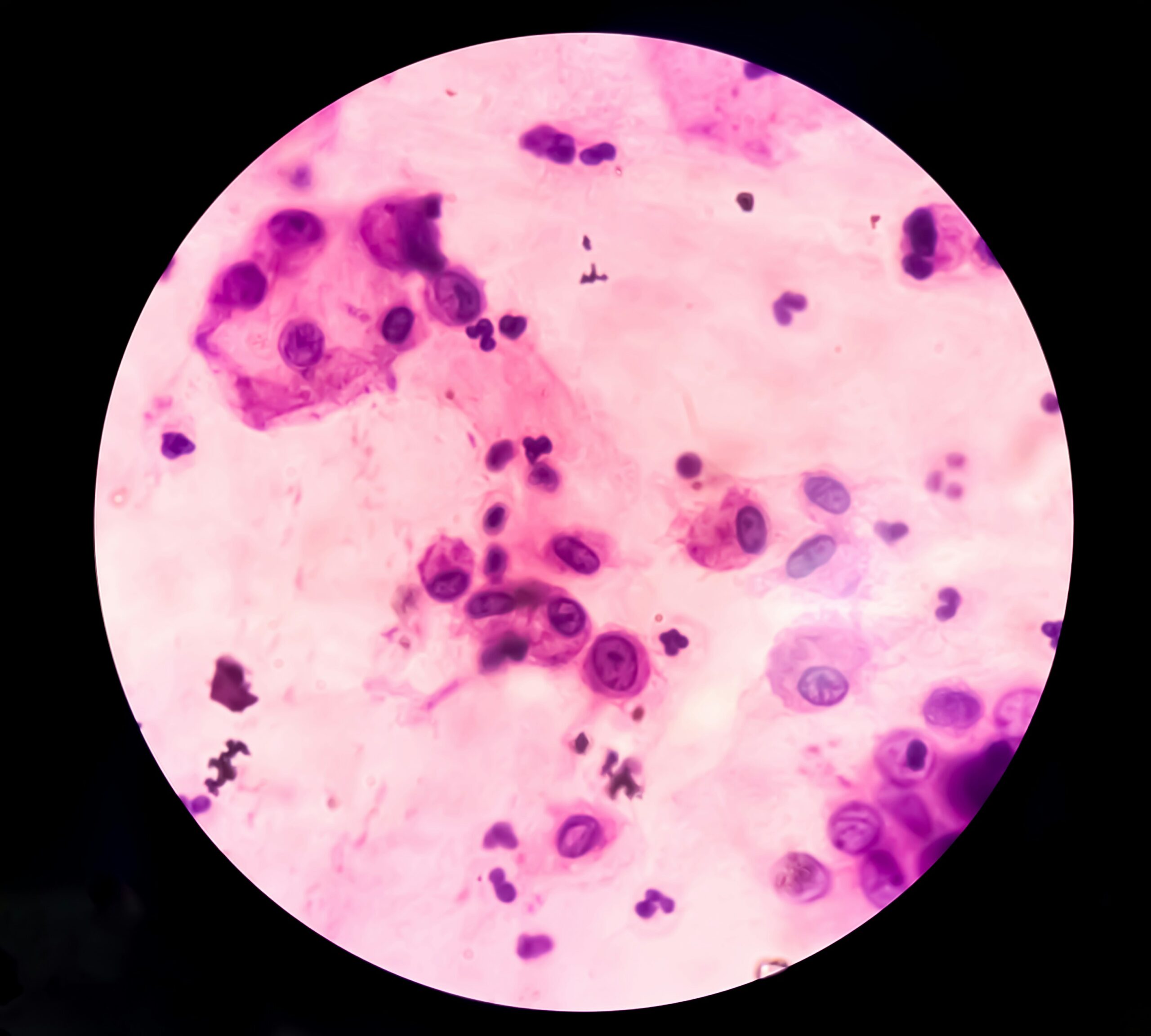 image of bacteria